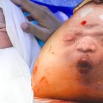 Baby In Fruchtblase Geboren